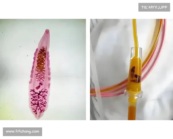 肝吸虫治疗后如何安全排除传染病 肝吸虫治疗后如何安全排除传染病
